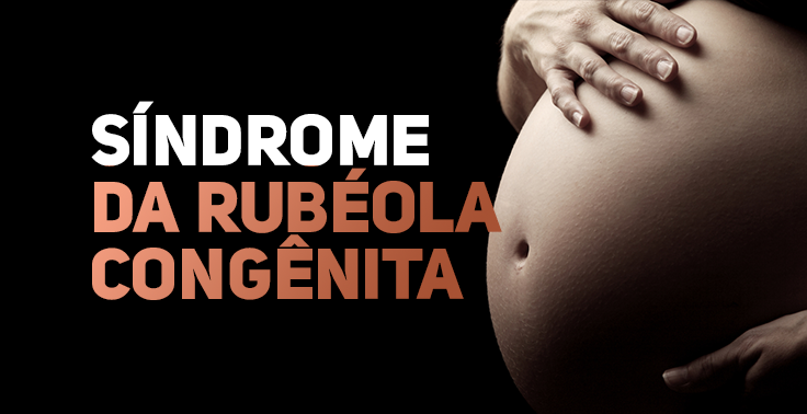 sindrome da rubeola congenita